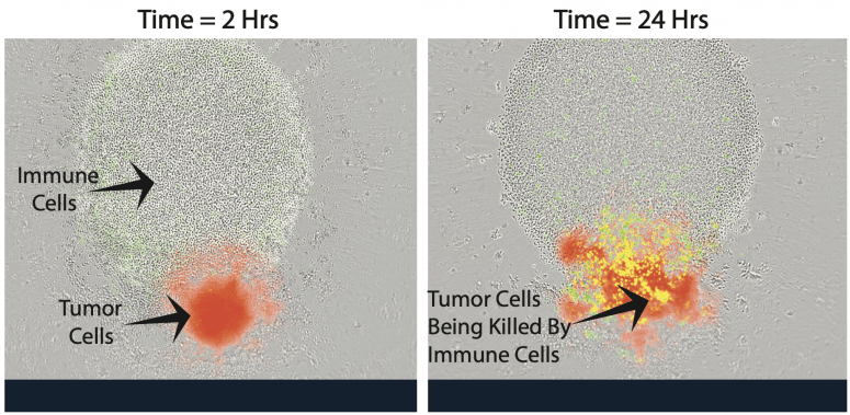 科学家使用靶向放射性核素疗法帮助免疫系统抵抗癌症