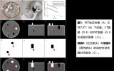 质子治疗的PET/CT验证显像 