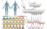 最新研究提供了人体全身葡萄糖摄取的详细图谱